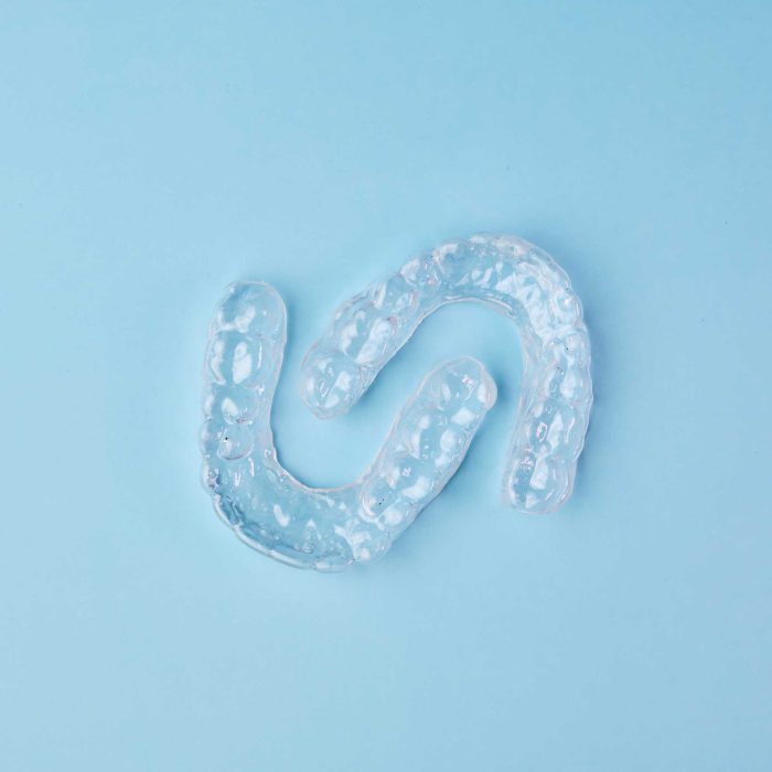 retainer-transparente-schiene_376729423 retainer-transparente-schiene_376729423